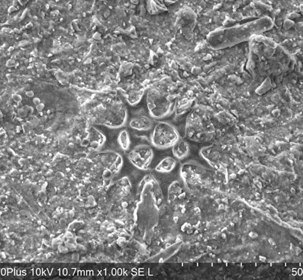 diatoms-in-flinders-lake-1.jpg